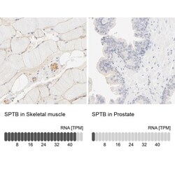 Spectrin beta 1 Antibody, Novus Biologicals 0.1mL; Unlabeled:Antibodies,